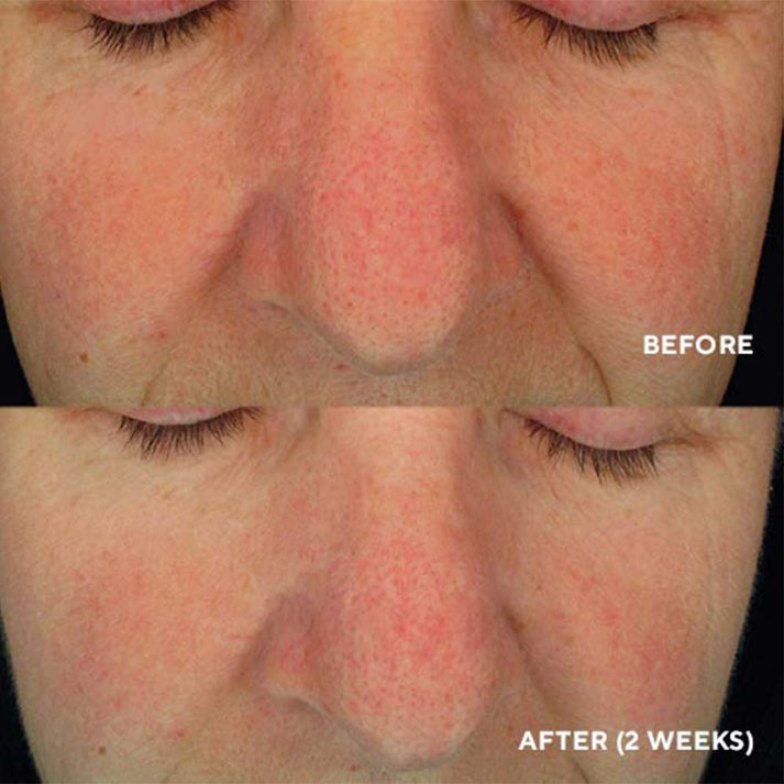 Soothing Serum