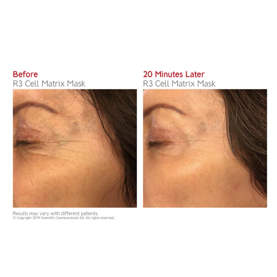 Dr Levy R3 Cell Matrix Mask