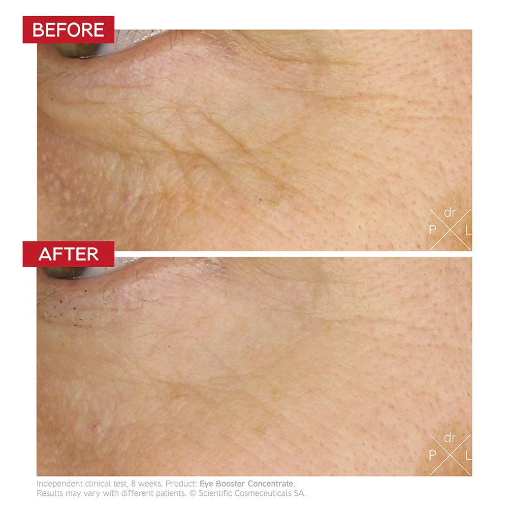 Dr Levy Eye Booster Concentrate 15ml