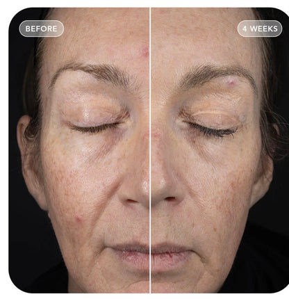 IMAGE Skincare VOL.U.LIFT™