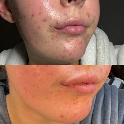 Clear & Calm Liquid Vitamin Supplement