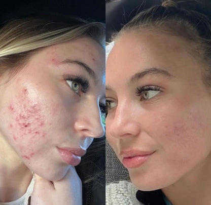 Clear & Calm Liquid Vitamin Supplement