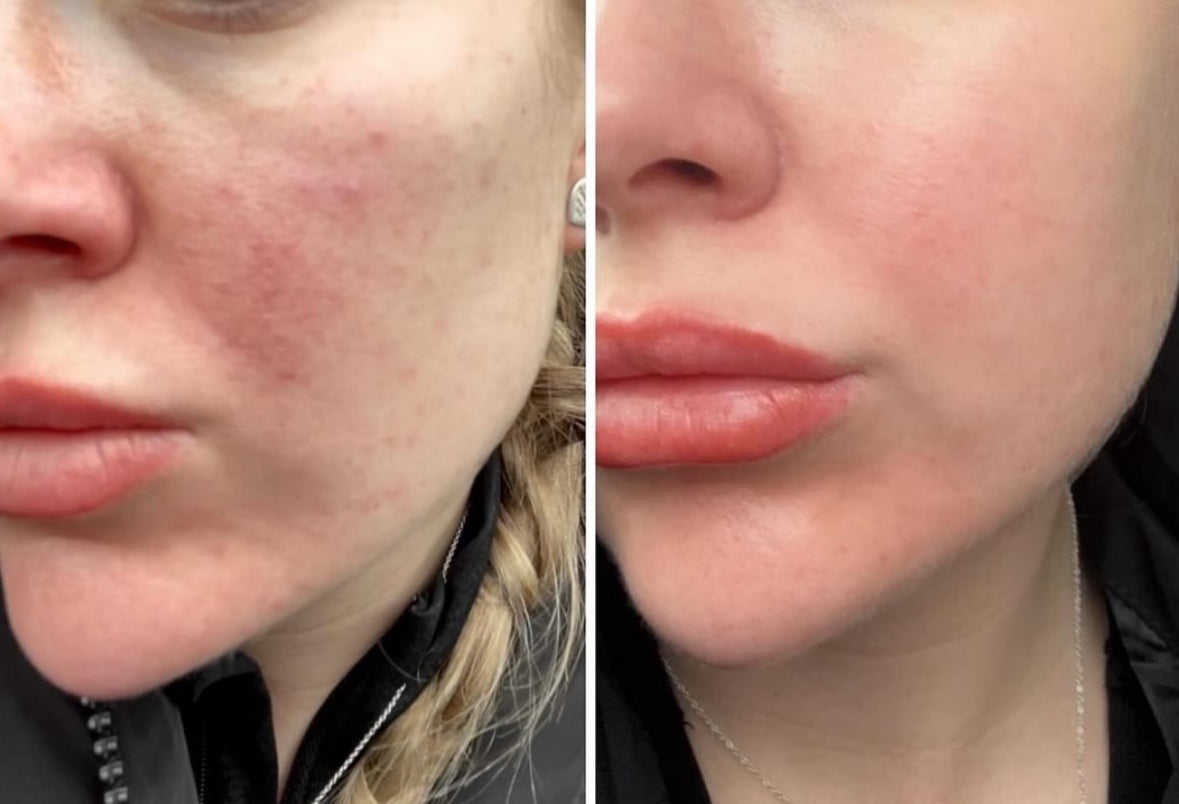 Rejuvenate & Firm Liquid Vitamin Supplement