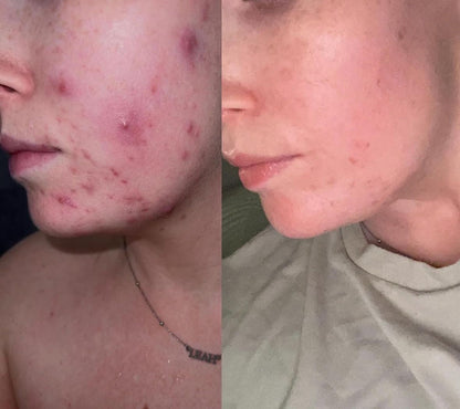 Clear & Calm Liquid Vitamin Supplement