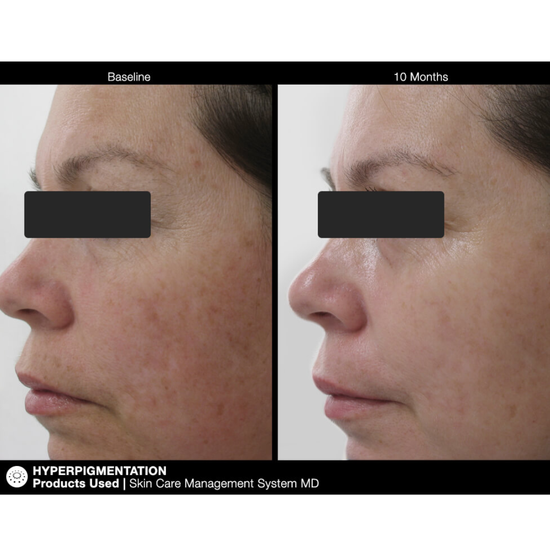 Jan Marini Skin Care Management System – Dry/Very Dry with Daily Face Protectant SPF 33