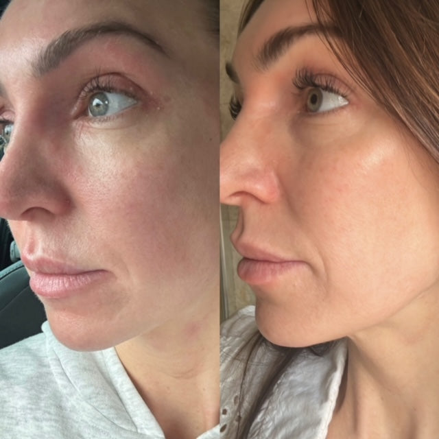 Illuminate & Hydrate Liquid Vitamin Supplement