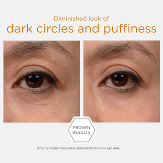 Enlighten Brightening Eye Cream 15g