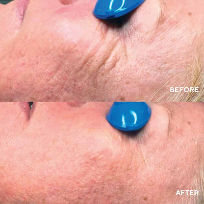 Collagen ReActivate PM