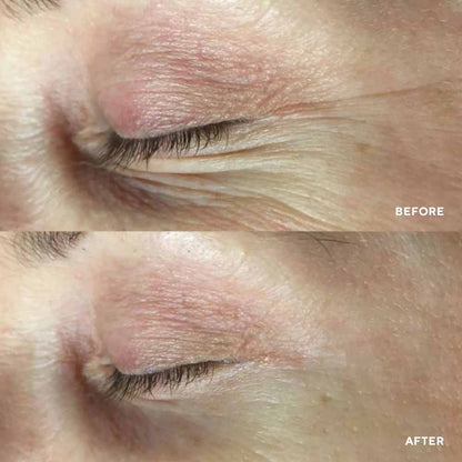 PolyPeptide Collagel Eye