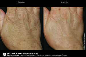Jan Marmi ReNu Corrective Hand Complex