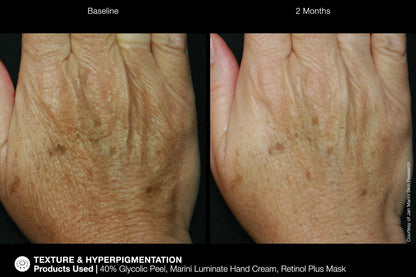 Jan Marmi ReNu Corrective Hand Complex