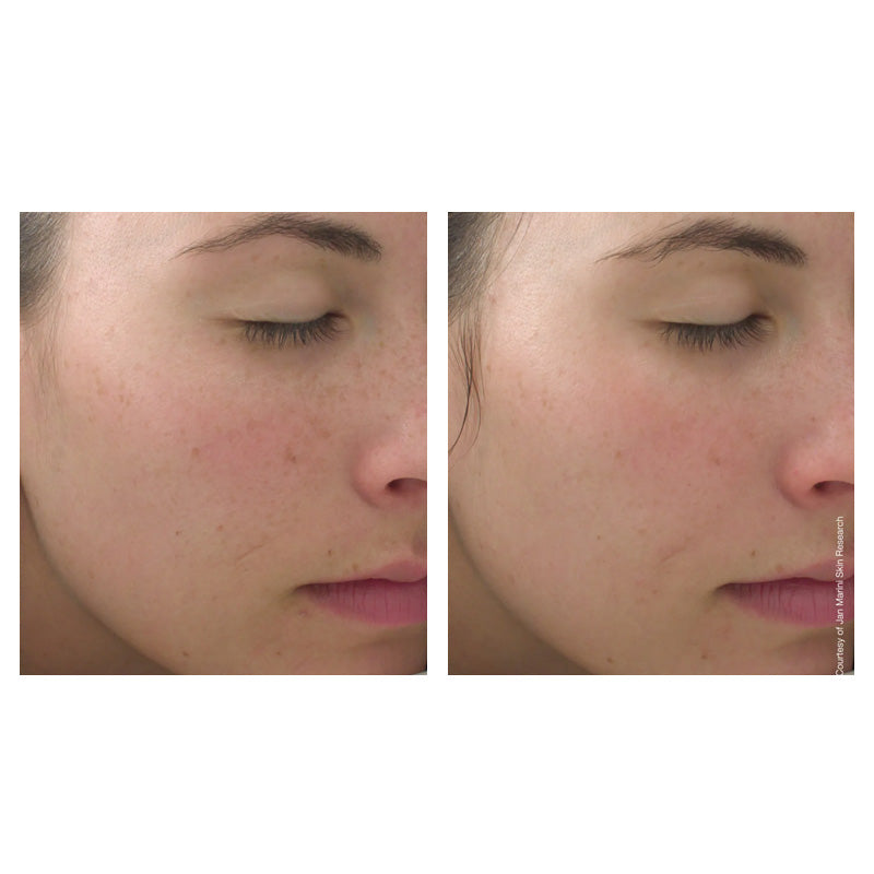 Jan Marini C-ESTA Face Serum