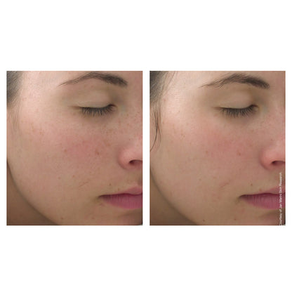 Jan Marini C-ESTA Face Serum