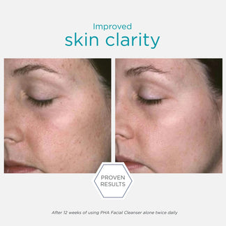 Restore PHA Facial Cleanser 200ml