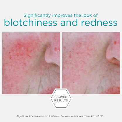 Restore Redness Neutralizing Serum 29g