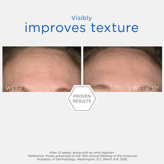 Resurface Smooth Surface Glycolic Peel 60ml / 36 Pads