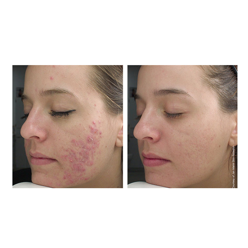 Jan Marini Bioclear Face Lotion
