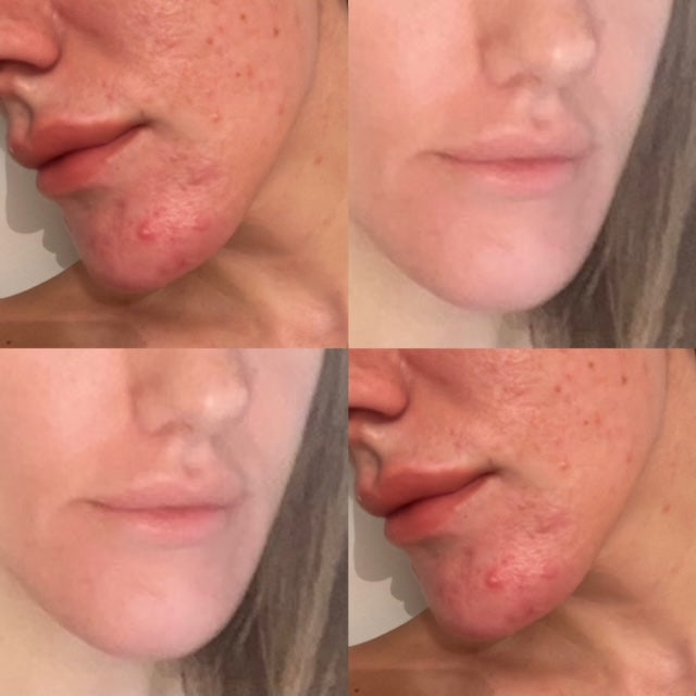 Clear & Calm Liquid Vitamin Supplement