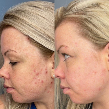 Clear & Calm Liquid Vitamin Supplement