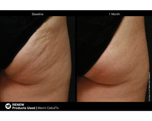 Jan Marini CelluliTx Cellulite Cream