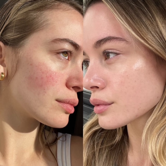 Illuminate & Hydrate Liquid Vitamin Supplement