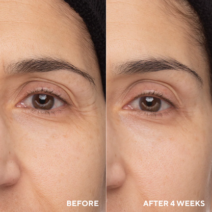 Travel-Size Retinol Eye Renewal