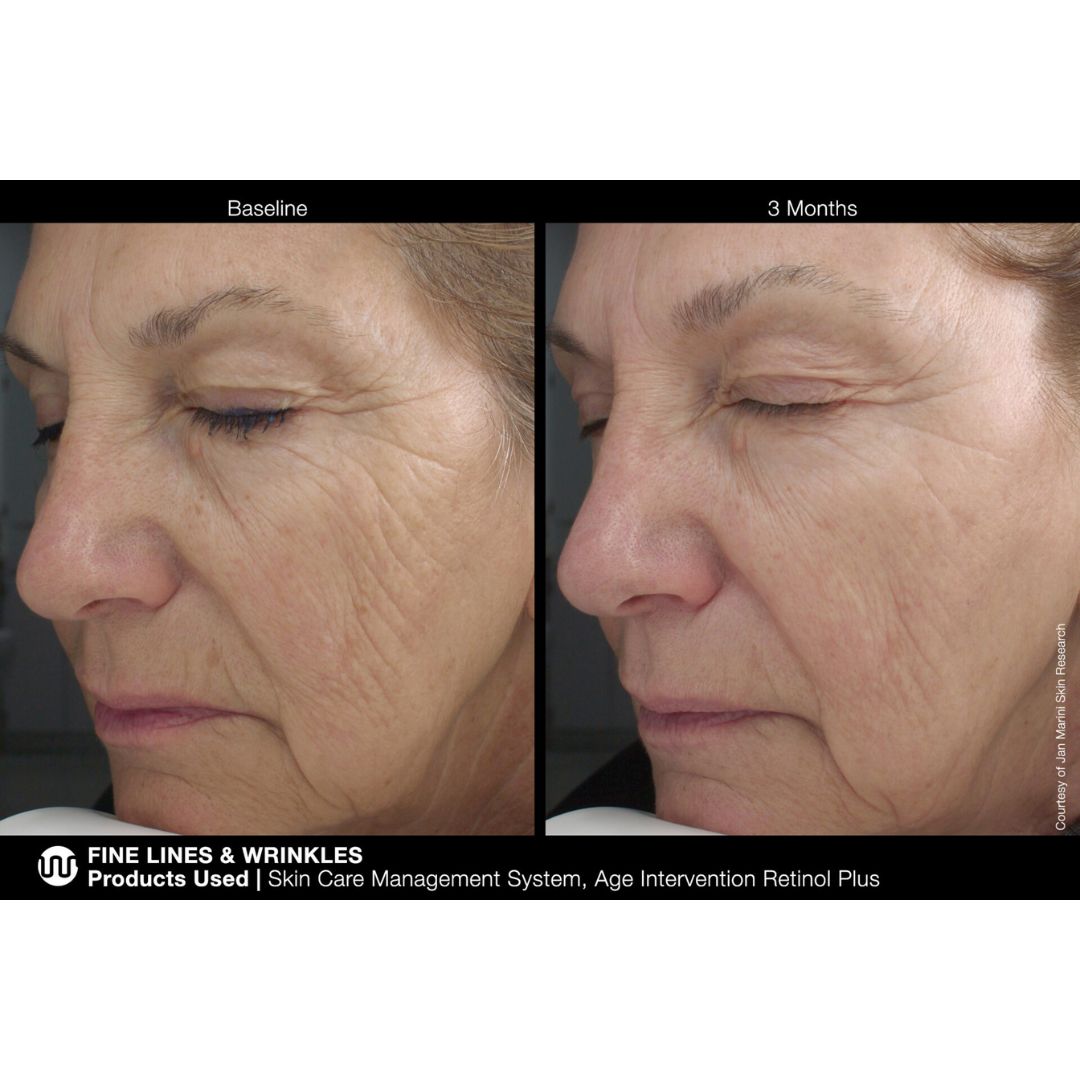 Jan Marini Age Intervention Retinol Plus