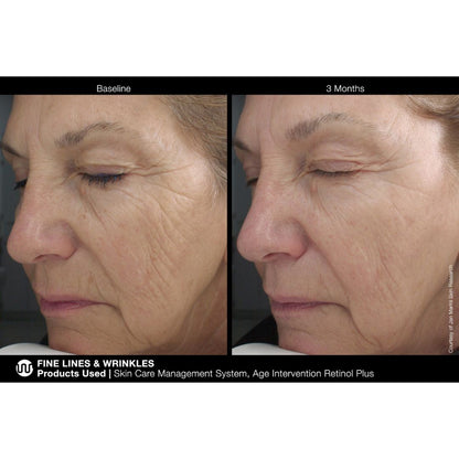 Jan Marini Age Intervention Retinol Plus