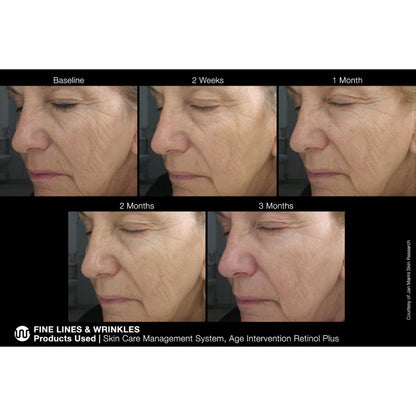 Jan Marini Age Intervention Retinol Plus