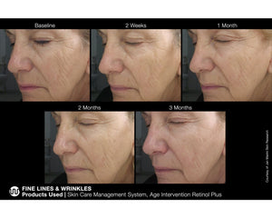 Jan Marini Professtinal Age Intervention Face Cream